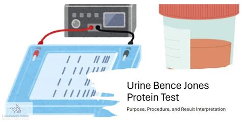 bence jones urine test nhs